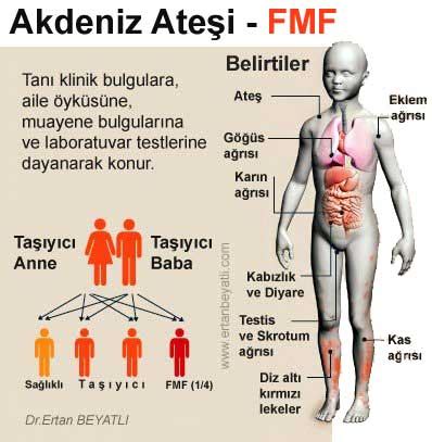 Akdeniz Ateşi Hastalığı