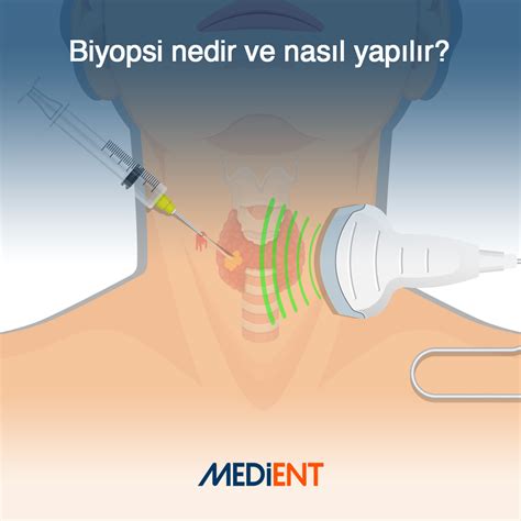 Biyopsi Nedir? Meme Biyopsi Nasıl Yapılır?