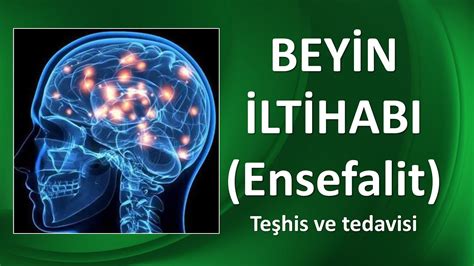 Ensefalit (Beyin İltihabı)