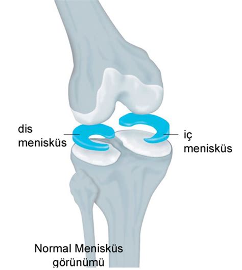 Menisküs