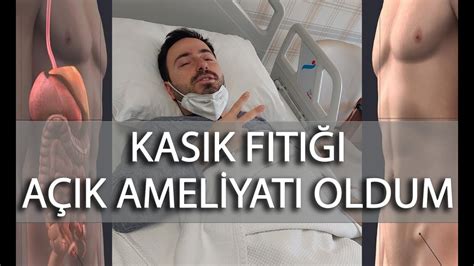 Kasık Fıtığı