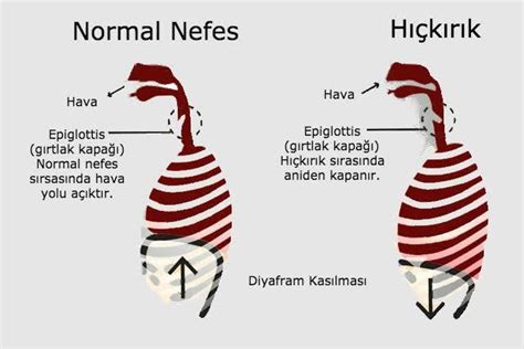 Hıçkırık Neden Olur? Hıçkırık Nasıl Geçer?