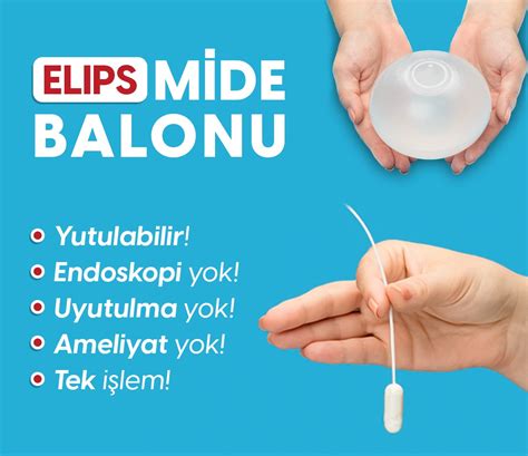 Yutulabilir Mide Balonu