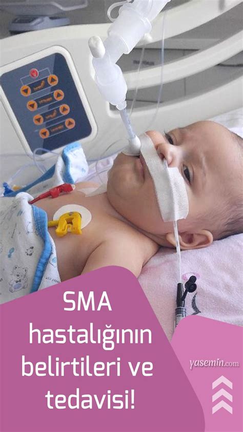 SMA Hastalığı