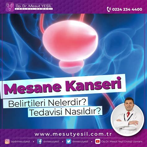 Mesane Kanseri